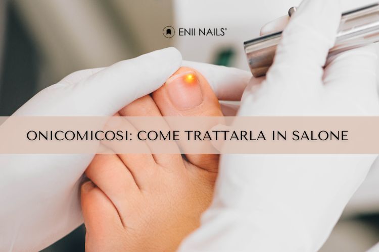 Onicomicosi: come trattarle nel tuo salone