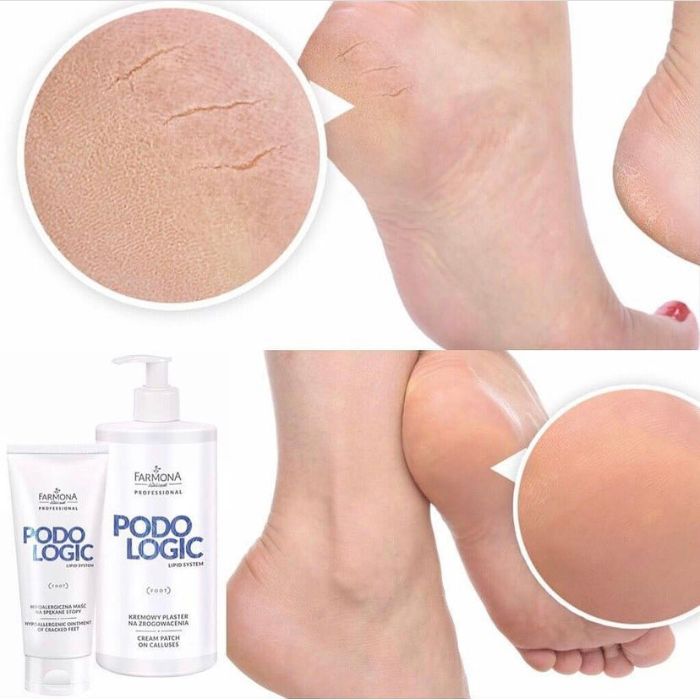 podologic lipid crema piedi farmona